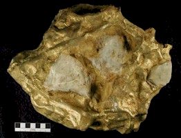 The Schlemm gold nugget
